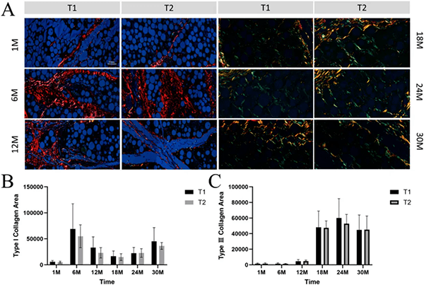 (A) Growth trends of Type I and Type III collagen fibers; (B) Statistical analysis of Type I collagen areas; (C) Statistical analysis of Type III collagen areas