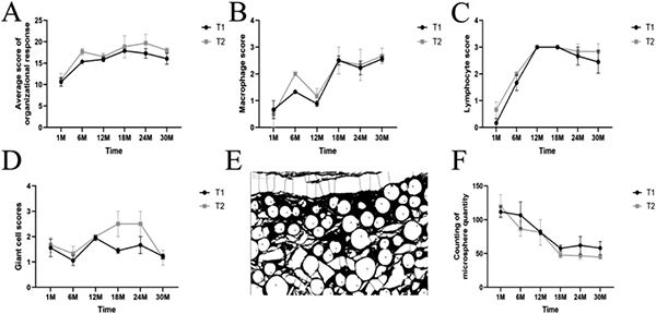 (A) Histological scores based on H&E staining; (B) Macrophage scores; (C) Lymphocyte scores; (D) Giant cell scores; (E) Quantitative analysis of the number of microspheres; (F