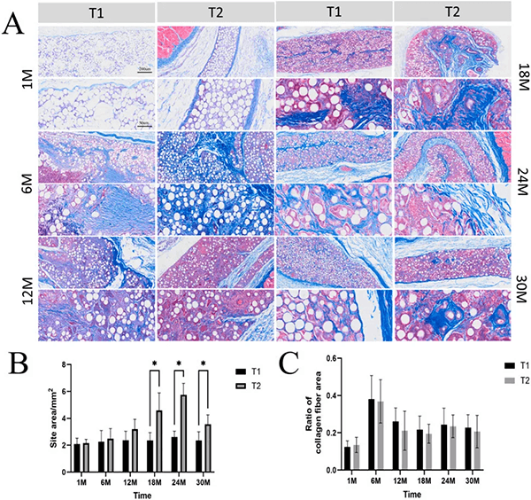 (A) Masson's trichrome staining results, showing the growth trend of collagen fibers; (B) Implantation site area; (C) Area ratio of collagen fibers