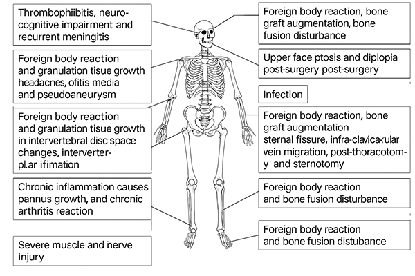 Adverse reactions caused by traditional bone wax implantation in the human body