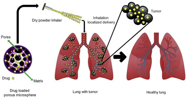 Application of porous microspheres in drug delivery