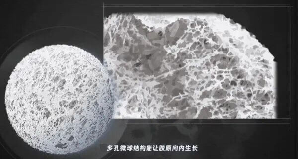 Facial fillers containing PDLLA porous microspheres