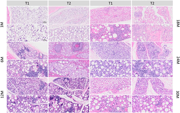 Hematoxylin and Eosin (H&E) staining images