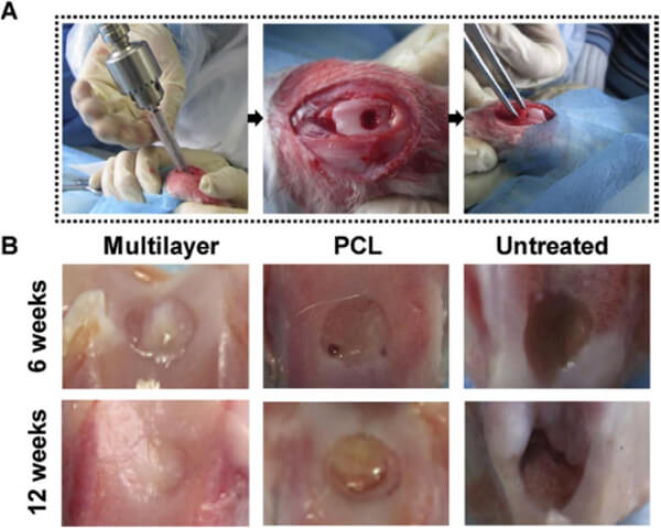 In vivo evaluation of SLS cartilage scaffolds