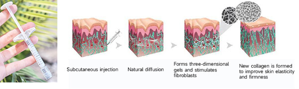 Mechanism of action of GOURI