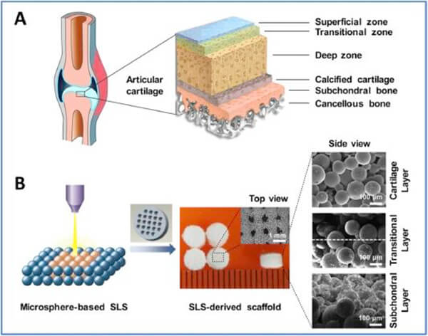 Natural osteochondral repair
