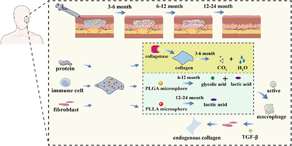 Schematic of PLLA&PLGA microsphere