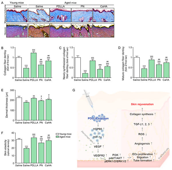 Upregulation of collagen fibers in aged skin following PDLLA injection